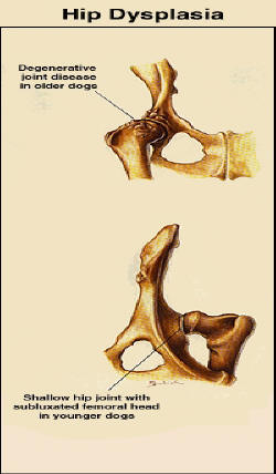 HIP DYSPLASIA